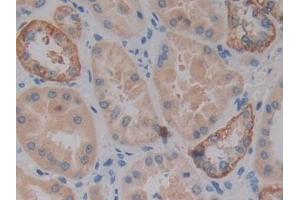 Detection of VSNL1 in Human Kidney Tissue using Polyclonal Antibody to Visinin Like Protein 1 (VSNL1)