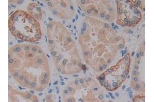 Detection of VSNL1 in Human Kidney Tissue using Polyclonal Antibody to Visinin Like Protein 1 (VSNL1) (VSNL1 anticorps  (AA 39-184))