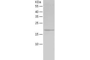 Fibroblast Growth Factor 18 (FGF18) (AA 28-207) protein (His-IF2DI Tag)