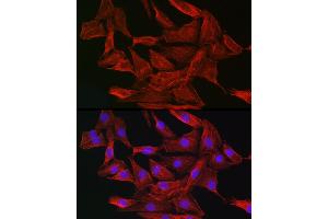 Immunofluorescence analysis of NIH-3T3 cells using Gelsolin Rabbit pAb (ABIN7267365) at dilution of 1:50 (40x lens). (Gelsolin anticorps  (AA 543-782))