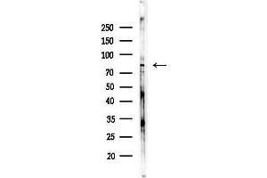anti-Ubiquitin Specific Peptidase 1 (USP1) (C-Term) antibody
