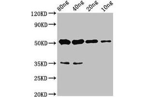 Western Blot Positive WB detected in Recombinant protein All lanes: cyp26b1 antibody at 4. (CYP26B1 anticorps  (AA 366-511))