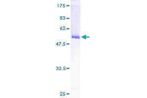 Image no. 1 for Glutamate-Cysteine Ligase, Modifier Subunit (GCLM) (AA 1-274) protein (GST tag) (ABIN1354926)