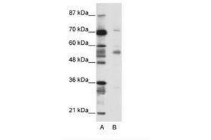 Image no. 1 for anti-Coronin, Actin Binding Protein, 1A (CORO1A) (N-Term) antibody (ABIN202574) (Coronin 1a anticorps  (N-Term))