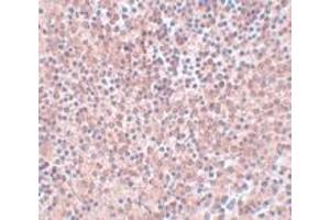 Immunohistochemistry (IHC) image for anti-Nanog Homeobox (NANOG) (Middle Region) antibody (ABIN1031009) (Nanog anticorps  (Middle Region))