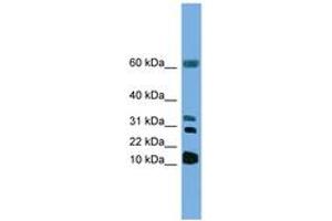 Image no. 1 for anti-Leukotriene C4 Synthase (LTC4S) (N-Term) antibody (ABIN6746296) (LTC4S anticorps  (N-Term))
