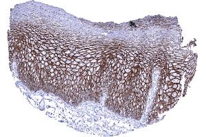 Esophagus squamous epithelium In the esophagus a strong membranous Dsg3 immunostaining predominantly occurs in the lower 2_3 of the squamous epithelium