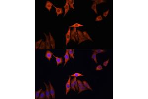 Immunofluorescence analysis of HeLa cells using KRAS antibody (ABIN3021676, ABIN3021677, ABIN3021678, ABIN1513137 and ABIN1514282) at dilution of 1:100. (K-RAS anticorps)