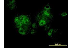Immunofluorescence of monoclonal antibody to MEF2A on MCF-7 cell. (MEF2A anticorps  (AA 71-170))