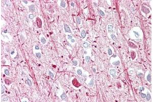 Anti-Androgen Receptor antibody IHC staining of human brain, cortex. (Androgen Receptor anticorps  (AA 621-670))