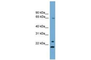 Image no. 1 for anti-Zinc Finger Protein 37A (ZNF37A) (AA 331-380) antibody (ABIN6745538) (ZNF37A anticorps  (AA 331-380))