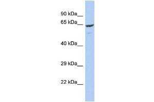 Host: Rabbit Target Name: FBXO21 Sample Type: OVCAR-3 Whole Cell lysates Antibody Dilution: 1.