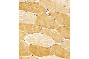 (ABIN6243301 and ABIN6578652) staining SLC29A2 in human skeletal muscle tissue sections by Immunohistochemistry (IHC-P - paraformaldehyde-fixed, paraffin-embedded sections). (SLC29A2 anticorps  (AA 1-31))
