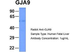 Host: Rabbit Target Name: GJA9 Sample Type: Human Fetal Liver Antibody Dilution: 1. (GJA9 anticorps  (Middle Region))