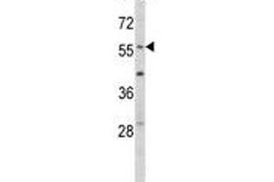 Western blot analysis of EGR1 antibody and mouse NIH3T3 lysate.