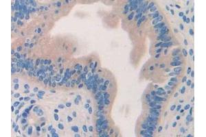 IHC-P analysis of Mouse Uterus Tissue, with DAB staining. (HYAL1 anticorps  (AA 52-462))