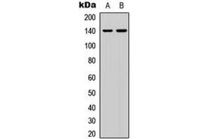 Western blot analysis of p140 Cap expression in HEK293T (A), HeLa (B) whole cell lysates. (SRCIN1 anticorps  (Center))