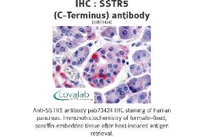 Image no. 1 for anti-Somatostatin Receptor 5 (SSTR5) (C-Term) antibody (ABIN1739677) (SSTR5 anticorps  (C-Term))