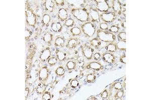 Immunohistochemistry of paraffin-embedded mouse kidney using TPI1 antibody (ABIN7270977) at dilution of 1:100 (40x lens).