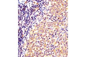(ABIN6243917 and ABIN6577996) staining (Mouse) Nr4a2 in mouse spleen sections by Immunohistochemistry (IHC-P - paraformaldehyde-fixed, paraffin-embedded sections). (NR4A2 anticorps  (AA 164-197))