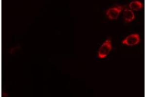 ABIN6267436 staining Hela cells by IF/ICC. (CBL anticorps  (pTyr674))
