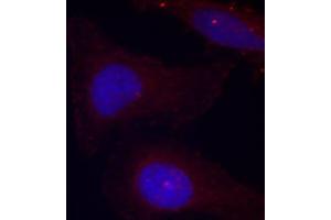 Immunofluorescence staining of methanol-fixed HeLa cells using Phospho-PTK2B-Y402 antibody (ABIN2987623). (PTK2B anticorps  (pTyr402))