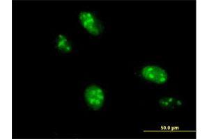 Immunofluorescence of purified MaxPab antibody to C1orf25 on HeLa cell. (TRMT1L anticorps  (AA 1-733))