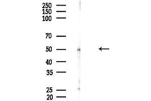 anti-Non-Syndromic Hearing Impairment Protein 5 (GSDME) (C-Term) antibody