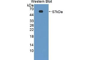Detection of Recombinant CTSG, Mouse using Polyclonal Antibody to Cathepsin G (CTSG)