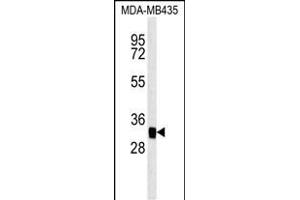 MTCH2 Antibody (N-term) (ABIN651683 and ABIN2840360) western blot analysis in MDA-M cell line lysates (35 μg/lane). (MTCH2 anticorps  (N-Term))