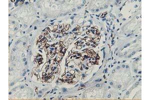 Immunohistochemical staining of paraffin-embedded Human Kidney tissue using anti-ADIPOQ mouse monoclonal antibody. (ADIPOQ anticorps  (AA 19-244))