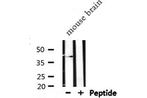 Western blot analysis of GAP43 expression in Mouse brain lysate