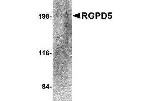 Western Blotting (WB) image for anti-RANBP2-Like and GRIP Domain Containing 5 (RGPD5) (N-Term) antibody (ABIN1031536) (RGPD5 anticorps  (N-Term))