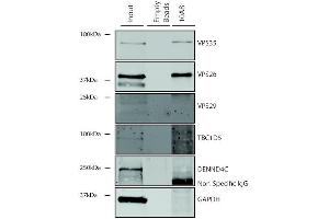 Immunoprecipitation analysis using Mouse Anti-VPS35 Monoclonal Antibody, Clone 10A8 (ABIN6932980).