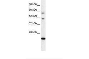 Image no. 2 for anti-BolA-like Protein 1 (BOLA1) (AA 24-73) antibody (ABIN6735869) (BOLA1 anticorps  (AA 24-73))