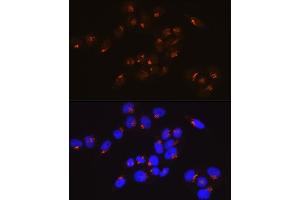 Immunofluorescence analysis of HeLa cells using GM130 Rabbit mAb (ABIN7267494) at dilution of 1:100 (40x lens).