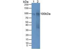 Western blot analysis of (1) Human Hela Tissue and (2) Mouse Ovary Tissue. (MUC16 anticorps  (AA 2-258))
