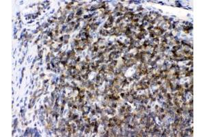 IHC testing of FFPE rat lymph tissue with ARHGEF1 antibody at 1ug/ml.