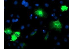 Image no. 2 for anti-Cytochrome P450, Family 2, Subfamily A, Polypeptide 6 (CYP2A6) antibody (ABIN1497722)