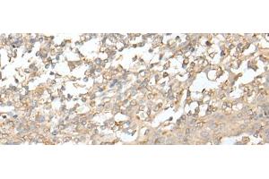 Immunohistochemistry of paraffin-embedded Human tonsil tissue using ZZZ3 Polyclonal Antibody at dilution of 1:50(x200)