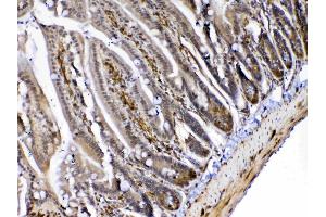 IHC analysis of MED4 using anti-MED4 antibody .