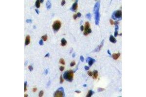 Immunohistochemistry (IHC) image for anti-RAB3A Interacting Protein (Rabin3) (RAB3IP) antibody (ABIN7308252) (RAB3IP anticorps)