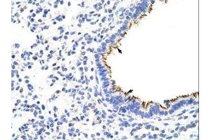 Image no. 1 for anti-Zinc Finger Protein 16 (ZNF16) (N-Term) antibody (ABIN6736214)