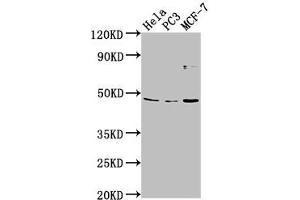 Western Blot Positive WB detected in: Hela whole cell lysate, PC-3 whole cell lysate, MCF-7 whole cell lysate All lanes: TMEM237 antibody at 1:2000 Secondary Goat polyclonal to rabbit IgG at 1/50000 dilution Predicted band size: 46, 45, 49, 36, 47 kDa Observed band size: 46 kDa (TMEM237 anticorps  (AA 59-78))