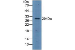 Figure. (FOSL1 anticorps  (AA 1-271))