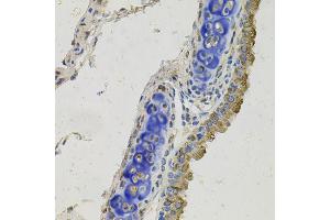 Immunohistochemistry of paraffin-embedded mouse lung using GAS6 antibody (ABIN5996448) at dilution of 1/100 (40x lens). (GAS6 anticorps)