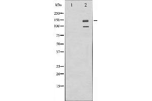 Western blot analysis of IGF1R expression in A549 whole cell lysates,The lane on the left is treated with the antigen-specific peptide. (IGF1R anticorps  (C-Term))