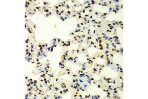 Immunohistochemistry of paraffin-embedded rat lung using SUMO2 antibody (ABIN6128719, ABIN6148726, ABIN6148728 and ABIN6218594) at dilution of 1:100 (40x lens). (SUMO2 anticorps  (AA 1-95))