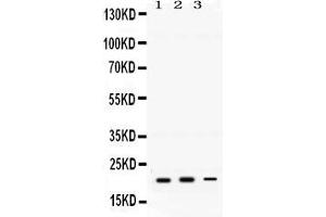 Anti-GTPase HRAS antibody, Western blotting All lanes: Anti GTPase HRAS  at 0. (HRAS anticorps  (C-Term))