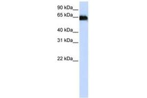 Image no. 1 for anti-ADAM Metallopeptidase Domain 12 (ADAM12) (AA 216-265) antibody (ABIN6743058)